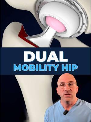 Hip Replacement & More Mobility 🔴🟢 Dual Mobility Hip Replacement = Better stability and reduced dislocation risk in hip replacement? Dual mobility technology - developed in France in the 1970s, features a "ball within a ball" design. The implant has (2) moving surfaces instead of one, creating a more stable joint that better mimics natural hip movements, live backup protection against dislocation:   - Significantly lower dislocation rates compared to traditional implants   - Greater range of motion    - Excellent option for active individuals   - Particularly beneficial for high-risk patients (elderly, neuromuscular conditions) . Studies show Dual Mobility #HipReplacement can reduce dislocation risk from 1-6% (traditional implants) to less than 1%. Modern designs have overcome early concerns about wear and complications, making this an increasingly popular choice for some patients. When to consider dual mobility?    ✅ Patients with higher dislocation risk    ✅ Those with complex revision surgeries    ✅ Patients with spinal conditions affecting hip mechanics    ✅ Elderly patients requiring extra stability Every patient's needs are unique, and dual mobility #jointreplacement can be an excellent option for some patients #hipmobiility  . 👇 SHARE your hip replacement experience & tip