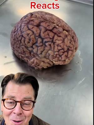 Brain surgeon explaining the brain #doctor #surgeon #brain #medicine