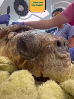 It is with heavy hearts that we report, Benson a Loggerhead Sea Turtle in rehabilitation at The Turtle Hospital has passed away.  Benson had barnacles removed so the veterinarian team could do a diagnostic endoscope. The scope confirmed Benson had internal FP tumors.  Benson had the LARGEST FP TUMOR ever recorded in a sea turtle.  The tumor weighed 28.2 pounds!! Caution, graphic content.  RIP Benson ..#connectandprotect #compassioniscontagious #rescuerehabrelease #seaturtlerescue #turtle #turtlehospital #marathonturtlehospital #theturtlehospital  #seaturtle #seaturtles #science  #seaturtlehospital #seaturtlerehab #wildlife #floridakeys #STEM #education #animals #animaltiktok #fyp #seaturtlelove #patient #savetheturtles #loggerheadseaturtle #loggerhead #loggerheadturtle #barnacleremoval #barnacles #seaturtlebarnacles #fpsucks 