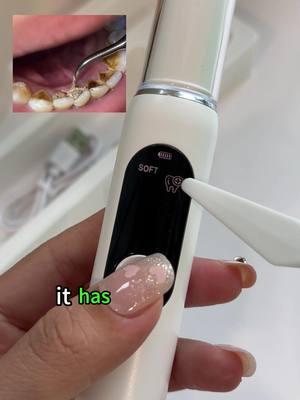 Save on dentist visits – this is truly a game-changing tool 😁🦷#dentalcleaning #DentalCare #tartarremover #cheanteeth #plaqueremoval #teethcleaner #teethcleaning 