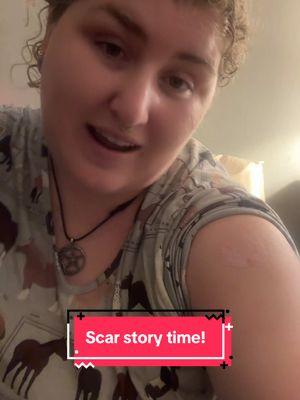 #stitch with @Jamie B | Solo Travel What are your scare stories?? I am a clumsy person who thinks I can do lots of crazy things! 😅  #story #storytime #storytelling #storytimes #scar #scarstory #scarstorytime #scarstoyourbeautiful #scarsarebeautiful #crazy #clumsylife #clumsyself #clumsyidea 