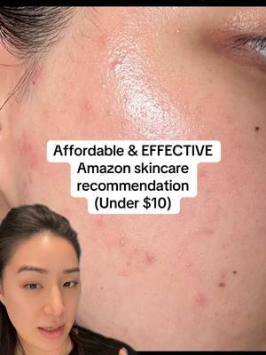 Effective skincare for under $10 ?!?!? Yes please!! @Thayers @Amazon #Ad #thayerspartner #Thayers #thayersacne #crueltyfree #vegan #amazonfinds #affordableskincare #greenscreen 