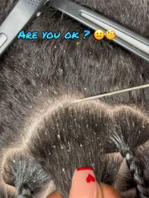 To answer yall question… NO ! I couldn’t 🙄 #perfectionist #neatparts #dandruff #dryscalp .#ocdproblems #dirtyhair  #orlandohairstylist #fyp #explore 