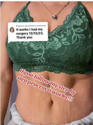 #fypシ #viral #panniculectomy #tummytuck #plasticsurgeonsoftiktok #trendingvideo 