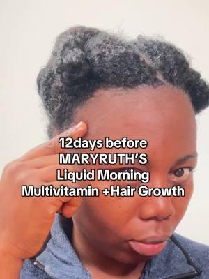 UPDATE on @MARYRUTH’S Multivitamin. #maryruthsorganics #maryruthsmorningmultivitamin #hairgrowth #multivitamin 