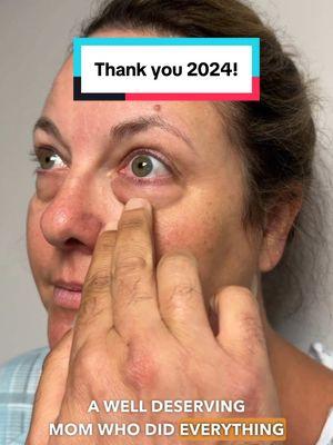 Thank you for an incredible 2024! ✨ Wishing you a happy, healthy and peaceful 2025. #kamiparsamd #trifectalift #eyebags #blepharoplasty #2024 #darkcircles #eyemakeup 