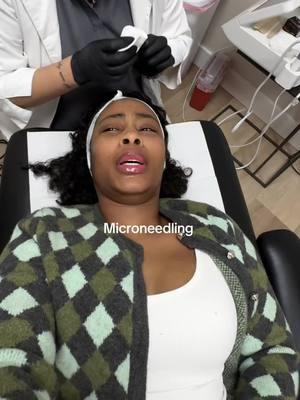 Ready to transform your skin? I tried @Skin Laundry Power Duo Facial with #microneedling + #lasertherapy, and my skin already looks brighter, smoother and supple ✨ 