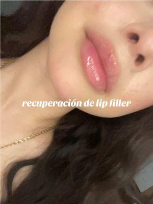 si tienen preguntas, pregúntenme!! 💗 #fyp #viral #parati #lipfiller #process #healing #beauty 