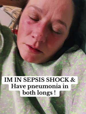 #sepsissurvivor #sepsisshock #sick #prayers