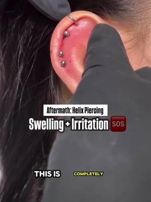 Helix Piercing Swelling and Irratation SOS using Base Laboratories Hypochlorous Acid Spray!!  @Base Laboratories @AnaMarpiercings #PiercingCare #helix #helixpiercing #HypochlorousAcid #piercing #BaseLabs #baselaboratories #piercingcare #piercings 