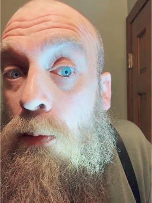 It’s been like this for a year and I don’t normally go to doctors #bearedbeeman #blueeyes #isthereadoctorinthehouse #optometrist #optometry #randpaul #fishallergy #beard #beardedmen #foru #forupage #foryou #foryoupage #foru #forupage #fypage #fy #fyp 