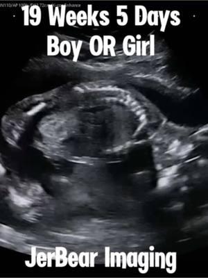 Boy OR Girl? #jerbearimaging #19weeks5days #boyorgirl #girlorboy #visitbrownwood #ultrasoundnearme #pinkorblue #blueorpink #heorshe #heorshewhatwillitbe #genderreveal #fyp  #momlife #motherhoodmoments www.jerbearimaging.com