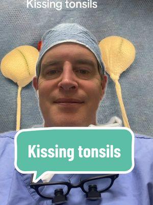 Enlarged tonsils or kissing tonsils, causing significant blockage of breathing and potentially sleep apnea. So if your child has kissing tonsils, you should get those checked out. #Tonsil #Surgery #TonsilSurgery #Tonsillitis #Snoring #Child #Pediatrics #Mom #Dad #kissing #ForYou