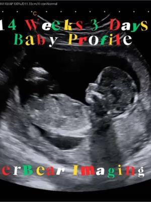 Cute Baby Profile 🥰 #jerbearimaging #ultrasoundnearme #14weeks3days #pregnant #peaceofmind #visitbrownwood #fyp #momlife #browncounty #DeLeon #bradytx #comanchetx #ultrasoundstudio www.jerbearimaging.com