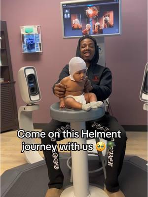 Goodmorning ☺️ we're not the only one , so we encourage parents , any questions feel free to ask , any suggestions, just be apart of our journey ☺️ #babyhelmet #fyp #jtandlegnation 