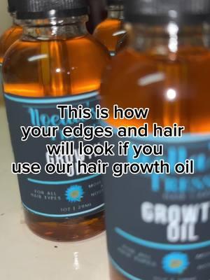 Link in the bio to shop our hair growth oil. Noellastresses.com  #hairgrowth #hairlossremedy #hairloss #hairlosssolutions #naturalhairtiktok #naturalhair #naturalhaircare #blackowned #blackownedbusiness #hairgrowthoil #blackownedhaircare  #cookingwithmula #cookingwithkya #blackownedhaircareproducts #haircareproducts #hairgrowthoils #viralgrowthoil #4chairgrowth #haircare #hairgrowth #TikTokShop #trending #digitalmarketing #digitalproducts #contentcreator #digitalproductsforbeginners #boholnotlessbraids #bohobraids #knotlessbraids #knotlessbohobraids #summerbraids #naturalhairproducts #blackownedhaircareproducts 