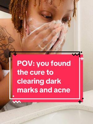 POV: you found the cure  to clearing dark  marks and acne #acne #darkmarks #hyperpigmentation #clearskin #glowing #glowingskin #fyp #acneskin #acnescars #skincare #turmeric #turmericsoap #kojicacidsoap #koji #pcos #pcos 