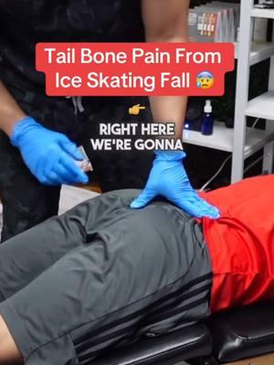 Tailbone pain from a fall from ice skating #chiropractic #tailbone #coccyx #coccyxpain  