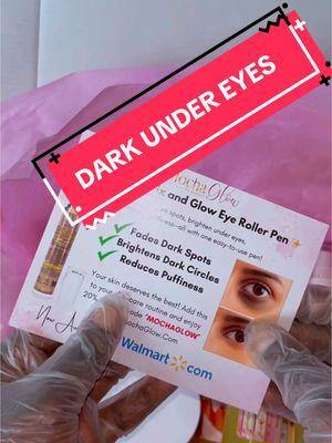 BYE DARK UNDER EYE CIRCLES! #darkspot #darkmark #hyperpigmentation #hyperpigmentationtreatment #darkcircles #darkundereye #CapCut 