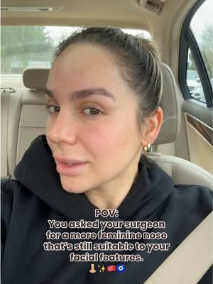 Officially 1 month post op from getting my nose job in Turkey 🥲😍👃🏼✨🇹🇷🧿 @Dr Deniz Dilek did an amazing job! I am so happy with my result already! 🥹💕 #nosejob #nosejobcheck #nosejobresults #nosejobturkey #turkeynosejob #nosejobbeforeandafter #newnose #newnosewhodis #nosejobdiary #rhinoplastybeforeandafter #rhinoplastyresult #surgeryinturkey 