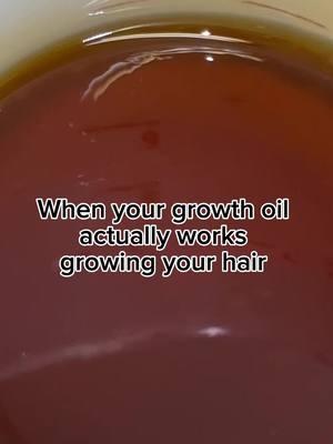 Link in the bio to shop our hair growth oil. Noellastresses.com  #hairgrowth #hairlossremedy #hairloss #hairlosssolutions #naturalhairtiktok #naturalhair #naturalhaircare #blackowned #blackownedbusiness #hairgrowthoil #blackownedhaircare  #cookingwithmula #cookingwithkya #blackownedhaircareproducts #haircareproducts #hairgrowthoils #viralgrowthoil #4chairgrowth #haircare #hairgrowth #TikTokShop #trending #digitalmarketing #digitalproducts #contentcreator #digitalproductsforbeginners #boholnotlessbraids #bohobraids #knotlessbraids #knotlessbohobraids #summerbraids #naturalhairproducts #blackownedhaircareproducts 