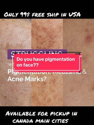 #hey_natural skincare #foryou #foryoupage  #eventoneskin  #skinlightening #skinbleaching #naturalingredients  #usawale  #canadawale #usadesi #desitiktok #viral  #viralvideo #pakistan #dubaidesi #UAE #uk #europe #viralreels #viralvideo #india #bollywood #acne #pigmentation #hey_natural skincare #foryou #foryoupage  #eventoneskin  #skinlightening #skinbleaching #naturalingredients  #usawale  #canadawale #usadesi #desitiktok #viral  #viralvideo #pakistan #dubaidesi #UAE #uk #europe #viralreels #viralvideo #india #bollywood #acne #pigmentation #desi #punjabi #punjabisongs #sidhumoosewale #punjab  #student #harvana #heynatural #heynaturaleeurope  #go viral  # trending  #LifeOnTikTok#desi #punjabi #punjabisongs #sidhumoosewale #punjab  #student #harvana #heynatural #heynaturaleeurope  #go viral  # trending  #LifeOnTikTok  #monetizedviews  #maskat waly  #bangladeshi   #foryou #foryoupage #yp #fyp #viralvideo #fyp≥* viral #fyn  #trending#pakistani tiktok# pakistani in USA