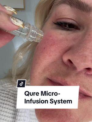 Transform dull skin with @Qure™ Skincare Micro-Infusion System! 𝘨𝘪𝘧𝘵𝘦𝘥/𝘱𝘳  The system helps to reduce the look of fine lines, dark spots and pores while it infuses serum directly into your skin, using 24k gold 0.5mm microneedles! It’s a fabulous #athome option that gives you the benefits of #microneedling but in a quick, easy and effective way! I love how the serum is infused into the skin while doing the treatment! The kit comes with everything you need including 2 different serums and disposable needle heads.  Doing this stamping method doesn’t damage the skin like derma-rollers possibly can plus the skin recovers quickly! Visit 𝗊𝗎𝗋𝖾𝗌𝗄𝗂𝗇𝖼𝖺𝗋𝖾.𝖼𝗈𝗆 for more deets! #qure #spatreatment #antiagingskincare #beautyeducator #beautytipsandtricks #over50 #matureskin #wrinkles #beautymix #againstaging #torilee 💋𝒯ℴ𝓇𝒾 ℒℯℯ