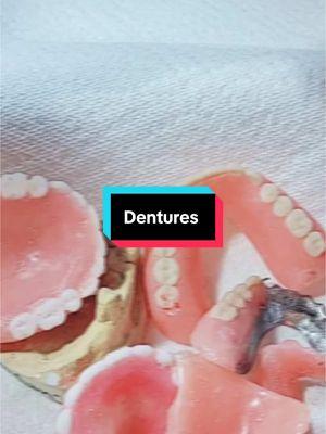 #LIVEhighlights #TikTokLIVE #LIVE Transforming Smiles, One Denture at a Time!”DentureLife #DentureCare #DenturesDaily #SmileTransformation #DentureJourney #CustomDentures #PremiumDentures #PartialDentures #DentureTips #AffordableDentures #ConfidentSmile #SmileMakeover #PerfectSmile #ConfidenceBoost #HappySmiles #SmileGoals #NaturalLook #LifeChangingSmile #BeautifulSmiles #SmileCare #DentalCare #OralHealth #HealthyTeeth #DentalTips #DentistApproved #OralHygiene #DentalAesthetics #ToothReplacement #DentalSolutions #ProstheticDentistry #BeforeAndAfter #SmileTransformationJourney #DentureResults #SmileGlowUp #TransformYourSmile #DentureReveal #SmileUpgrade #NewSmileNewYou #SmileInspo #ConfidenceTransformation #TikTokMadeMeDoIt #TrendingNow #ViralContent #ForYou #ForYouPage #TikTokTrend #ContentCreators #TikTokMadeMeSmile #ExplorePage #FYP #EverydayConfidence #NewBeginnings #LiveLaughSmile #DentureStories #ConfidenceEveryDay #BetterSmileBetterLife #SmilingThroughLife #EmpoweredSmiles #SmileStronger #ComfortAndStyle #DentureEducation #HowToDentures #DentureTutorial #DentureFacts #LearningWithDentures #DenturesExplained #ProTipsForDentures #DentureCareTips #AskADentureExpert #DentureInsights #DentureCraftsmanship #HandmadeDentures #LabMadeSmiles #CustomMadeSmiles #SmileArt #DentureArtistry #LabExpertise #ProfessionalDentures #CraftingSmiles #ArtOfDentures #LoveYourSmile #BoostYourConfidence #SmileTransformationStory #FeelGoodSmile #YourSmileMatters #DentureCommunity #DentureTalk #TikTokDentures #BestSmileTips #SmilingMatters