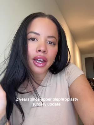 2 years upper blephroplasty update! I still get so many messages about it and honestly I can’t recommend it enough 🫶🏽 #upperblepharopasty #surgerytiktok #upperbleph 