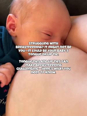 Struggling with breastfeeding? It might not be you—it could be your baby’s tongue or lip tie. These ties can impact your baby’s latch, milk transfer, and even your milk supply. Here are some signs to watch for: 👶 Baby has trouble latching, makes clicking sounds, or seems fussy during feeds. 🤱 Mom experiences sore nipples, blocked ducts, or a dropping milk supply. The good news? With the right support—like a lactation consultant or a simple frenectomy—breastfeeding can get easier. If this sounds familiar, don’t wait to seek help. Breastfeeding shouldn’t hurt! Tag a mama who might need this info! 💛 #breastfeedingjourney #tonguetie #liptie #mamasupport #newmomlife #breastfeedinghelp #lactation #momlifehacks #postpartumtips #babyhealth #breastfeedingmom #breastfeedingproblems #breastfeedingmama #newborncare #momssupportingmoms #lactationconsultant #infantfeeding #nursingmom #holisticmom #naturalparenting