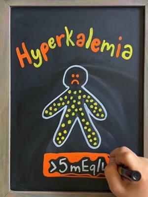 🩸 Hyperkalemia Hyperkalemia occurs when potassium levels are >5 mEq/L ⭐️ Potassium Functions ➡️ Balances fluid volume ➡️ Supports nerve transmission ➡️ Regulates muscle functioning ➡️ Maintains heart contractility ‼️Hyperkalemia can quickly lead to lethal dysrhythmias—requiring urgent action! Causes Burns (damaged cells release potassium) Addison’s Disease (low aldosterone decreases potassium excretion) Excessive Intake (IV fluids, supplements, high-potassium foods) Medications (ACE inhibitors and potassium-sparing diuretics) Decreased Excretion (kidney disease) Symptoms ➡️ Muscle cramps and weakness ➡️ Decreased urine output ➡️ Respiratory distress ➡️ Decreased cardiac contractility ➡️ EKG changes (peaked T waves) ➡️ Decreased reflexes 💬 Comment below if this helped and share with a fellow nursing student! #nursingstudent #nursingschool #hyperkalemia #nursingfundamentals #nursetok #nursingstudents #nursingeducation #nclexreview #nursingstudentsoftiktok #nursingtiktok #nclex #nclexrn #nursetiktok