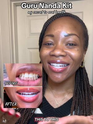 My secret to fresh breath and pearly whites 😬 @GuruNanda LLC  #whiteteeth #gurunanda #mouthwash #oralhealth #oilpulling #bundledeals #dentalhygienist #yellowteeth #TTSACL #teeth #oralhygiene #TikTokShop #beforeandafter #honestreview #fyp #trending #Lifestyle #trendingvideos #SelfCare #selfcareroutine #ttsdelightnow #MadeMYear #unboxin #ttshop #beforeandafter 