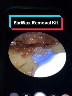 Ear Wax Removal Kit #earwax #earwaxremoval #earwaximpaction #earwaxtool #earwaxcamera #earwaxremovalkit 