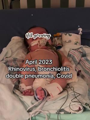 #CapCut  I thought as my babies got bigger i wouldnt have to be so scared of sickness. The thought of an illness being able to reek such havoc on their poor little bodies just breaks me. We have the same nurse tonight that we had last year and she is hands down the most amazing nurse ive ever met. #pnuemonia #rsv #icu #heartbroken #baby 