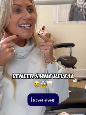 Hearing that there isn’t one thing she would change is music to our ears 😭🤍 We love her smile just as much as she does! 🦷 DM us for a free consultation!  #veneers #confidence #confidenceboost #smilemakeover #teeth #newteeth #newsmile 