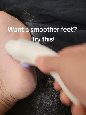 #creatorsearchinsights  Get it while it's cheap. How to remove callus from your feet at home Home remedy callus removal from feet worst callus feet. Callus removal from feet back people What cause callus feet in feet. Diy Best callus removal feom feet. #tiktokshopp #pedicurekit #pedicurecallus #ttsd #GiftGuide #mademyyear #TikTokShop #removecallus 