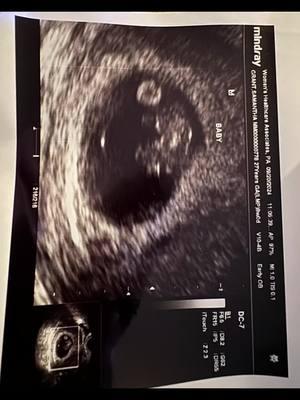 Baby G coming 2025 🥰🩵 #teamboy #babyboy2025 #babyayalahill #fyp #foryoupage @Clifton Hill 