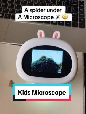 This looks so scary😱 #microscope #kidsmicroscope #microscopes #spider #scienceexperiments #creepycrawly 