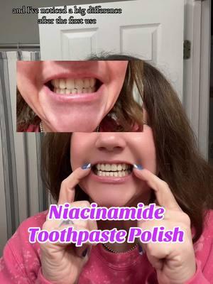 Honest Review! #niacinamide #niacinamidetoothpaste #teethwhitener #oralcare #tiktokshopreview #honestreview #tiktokshopfinds @FEISIDELIN US 