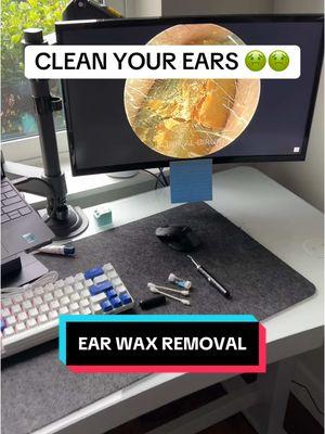 Get your ears cleaned with this ear wax removal tool! #earwaxremoval #earwax #earcleaningtool #newyear #newyearnewme 