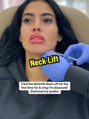 #botox #necklift #neferittinecklift #frozen #injectionday #botoxcheck  #botoxnatural #crowsfeet 