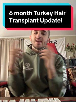 6 month Turkey Hair Transplant Update! #hair #hairloss #hairgrowth #hairprogress #haircare #hairline #recededhairline #regrowth #bald #balding #thinning #thinhair #thick #full #products #medication #treatment #finasteride #minoxidil #scalpmassager #rosemaryoil #dermaroller #xyon #xyonpartner #growplex #aimike #rogaine #keeps #hims #propecia #kirkland #topical #foam #liquid #oral #pill #journey #transformation #daily #series #day180 #tutorial #stepbystep #routine #regimen #results #proof #beforeandafter #slowlybutsurely #trusttheprocess #followalong #explanation #education #explained #DHT #hairfollicles #baldspot #howto #consistency #everyday #nevergiveup #positivity #motivation #hairtok #fyp #viral #xybca #chris #zeph #ibby #freddy #turkey #vitamins #biotin #hairtransplant #grafts #donorarea #complex10 #suppliment #prescription #hairfibers #hairfiller #fibers #veraclinic #mane #maneexlirblend #maneoils #maneoilblend #price #turkey #istanbul #medicatedlotion #lightlytap #update #informative 