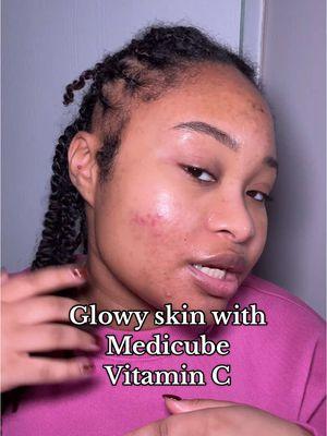 Replying to @Nay | Fashion Creator really been working on my skin recently and the @Medicube Global deep vita c capsule cream has been helping with brightness and glow! #vitaminc #medicube #glowyskin #hyperpigmentation #brightskin #vitamincskincare 