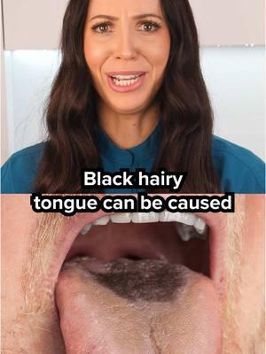 If you overuse hydrogen peroxide, you run the risk of black hairy tongue. Yes, it can be used as an oral debriding agent to be used AS NEEDED to help remove mucus, relieve minor mouth irritation, or if you just had gum surgery and your dentist recommended you to swish with it for a few days (there’s several different reasons to use it as an oral rinse for a short-amount of time)... But it is not intended to be used daily (without dilution) forever and ever. For more details, be sure to watch my full length video on YouTube.com/TeethTalk by searching “hydrogen peroxide teeth talk” and it will pop right up ☮️❤️🦷 #hydrogenperoxide #dentalhygienist #rdh #dental #teeth #blackhairytongue #hairytongue #tongue #dentalhygiene #mouthwash #cleanmouth #cleanteeth 