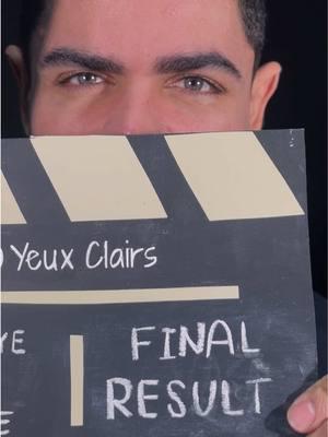 Lights, camera, change!🎬🎥 More results: www.yeuxclairs.com #yeuxclairs #realtreatmentresult #beforeandafter #eyecolorchange #eyecolorchangesurgery #eyecolorchanges #safeeyecolorchange #permanenteyecolorchange #lasereyercolorchange 