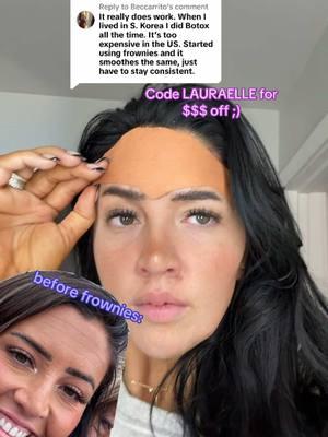 Replying to @Beccarrito @Frownies   7 months consistency! An insane Botox alternative that actually works!! 1st link in bio gets you $$ off or code LAURAELLE #frownies #frowniesfacialpatches #botoxalternatives #foreheadlines #foreheadlinesbegone #finelinesandwrinkles #frowniesbeforeandafter #frowniesresults 