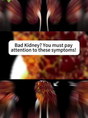 #kidneyfailure #kidneystone #Recipe #kidney #kidneydisease #fyp #kidneycancer #health 