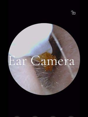 So disgusted I cannot believe my ears were this dirty #EarCamera #EarwaxRemoval #Earwax #EarPick #EarCleaner #SelfCare 