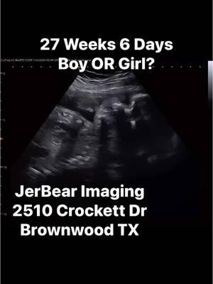 Can you guess? #jerbearimaging #ultrasoundnearme #visitbrownwood #girlorboywhoknows #27weeks6days #girlorboy #fyp #blueorpink #boyorgirl #browncounty #pinkorblue #heorshewhatwillitbe #genderreveal #genderultrasound www.jerbearimaging.com