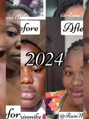 Flawless skin is what we serve. Let’s see a recap of our success stories 2024 .video #reviews #skincaresolutions #skincarereview #foryourpage #viralvideo #rainmikegeneralbeauty #skincaregh #ghanatiktokers🇬🇭🇬🇭🇬🇭 #usa_tiktok .video #mojo.video 